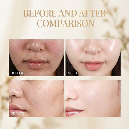 Korean Rice Glow Exfoliating Ampoule — Peel Shot for Pore Tightening, Repair & Brightening