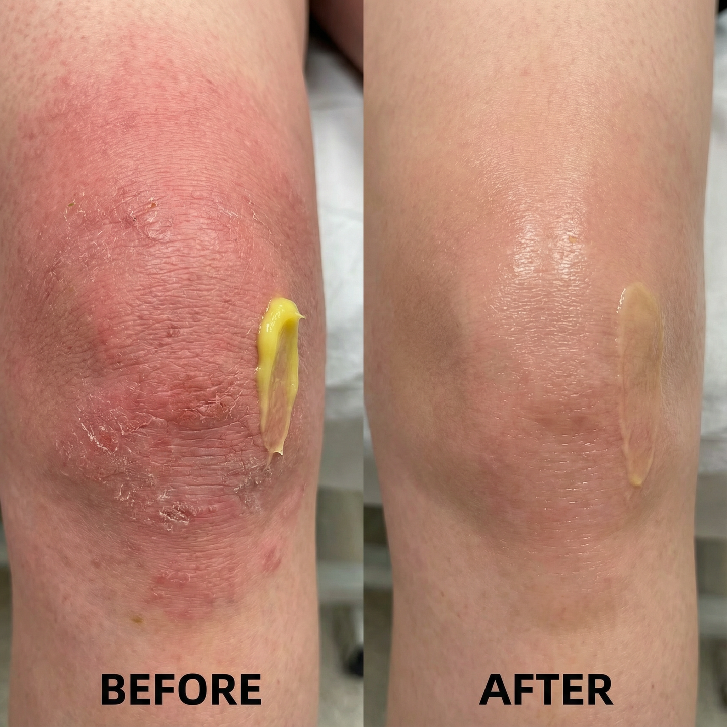 Bee Venom Care Cream